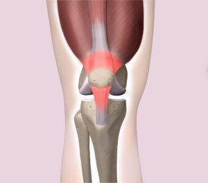 膝周りの筋肉と膝蓋骨